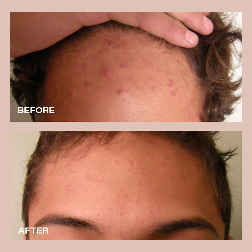 Before using VANA